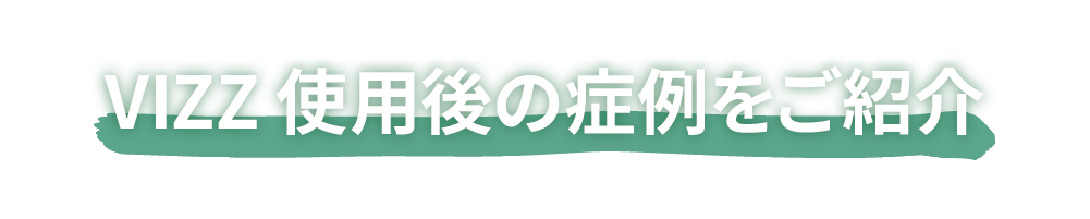 VIZZ 使用後の症例をご紹介