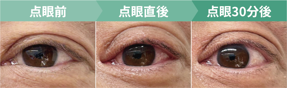 VIZZ 使用後の症例
