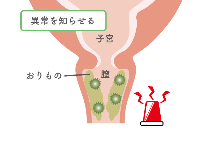 おりものの量や色、においが変化！？これって病気？おりものの状態から症状をセルフチェック！ | ネオクリニック